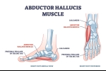Abductor Hallucis Pain: Causes and Treatment Options