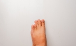 Brachymetatarsia Surgery: What It Is and How It Works
