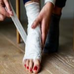 How to Treat a Stubbed Toe So It Heals Quickly