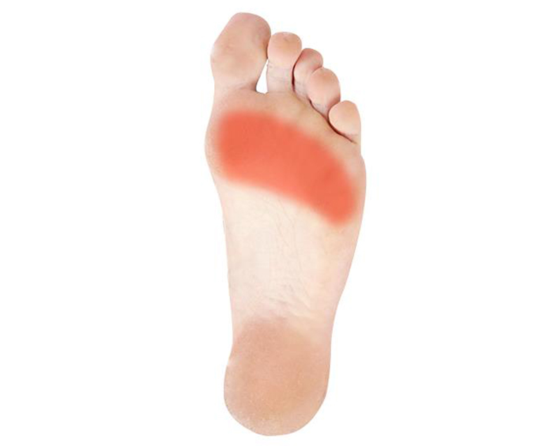 Pain on the Bottom of the Foot