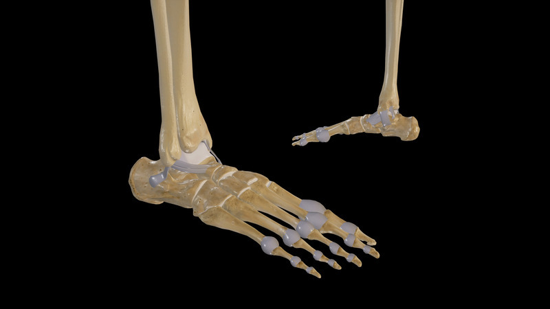 Medial Malleolus Fracture